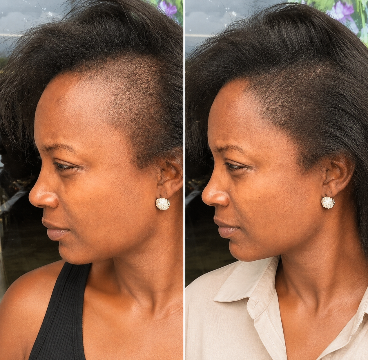 Eelhoe - Hair Growth Oil