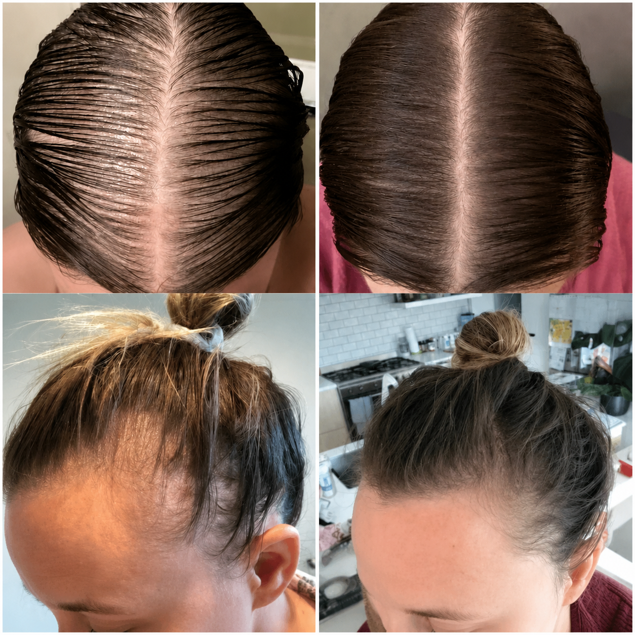 Eelhoe - Hair Growth Oil
